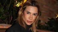Muere el influencer y estilista brasileño Júnior Dutra a los 31 años por complicaciones tras la cirugía “foxy eyes”