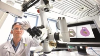 Amiloidosis cardiaca: infradiagnosticada e infratratada, pero con nuevas esperanzas