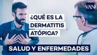 Dermatitis atópica, síntomas, causas y tratamientos que funcionan