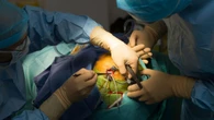 Tres personas renuncian a la eutanasia tras recibir una neurocirugía para tratar el dolor