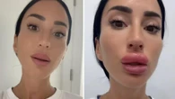 Aurah Ruiz da el paso y dice adiós al relleno de sus labios: “Un día, al mirarme al espejo, ya no me reconocía”