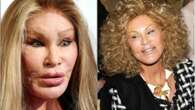 La adicta a la cirugía Jocelyn Wildenstein muestra su impresionante antes y después