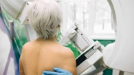 Llega un avance ante al cáncer de mama para más de 3.000 mujeres al año en España