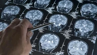 ¿Cómo reacciona nuestro cerebro al miedo?