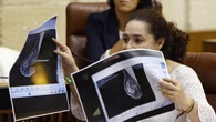 La Junta eleva a 2.317 las afectadas por el cribado del cáncer de mama y 1.778 de ellas se han hecho ya mamografías