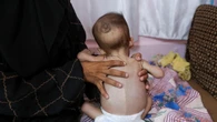 Un ataque israelí al principal hospital del sur de Gaza causa 14 muertos, entre ellos un periodista