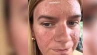 Sintió un pinchazo mientras dormía y, horas después, empezó a vivir una pesadilla: “Fui a urgencias”