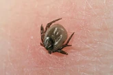 Warto wiedzieć Uważaj na kleszcze! Co warto wiedzieć o kleszczowym zapaleniu mózgu i boreliozie?