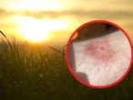 Letnia plaga zakażeń Coraz więcej zakażeń w Polsce! Jedno ukąszenie może zrujnować ci wakacje. Eksperci apelują o ostrożność