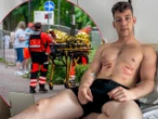 Szok Ratownicy rozjechali biegacza? Dramat podczas półmaratonu w Ostródzie. "Ocknąłem się w karetce"