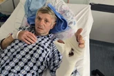 Na ratunek Sekunda nieuwagi i tragedia. "Albo palec, albo papierosy"