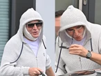 Cały w opatrunkach i szwach Nowa twarz Krzysztofa Gojdzia! Zrobił lifting i wyciął powieki... Zdjęcia paparazzi przerażają!