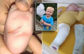 Zbiórka na operację Chory Tymek potrzebuje naszej pomocy. "Chcę być jak inne dzieci, grać w piłkę"