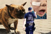 Policja szuka właściciela psa Pies pogryzł 4-letniego Franka „To było coś strasznego”