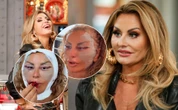 Oceńcie! Dagmara Kaźmierska pokazała nową twarz! "Goi się jak na psie!". Tak wygląda 3 dni po…