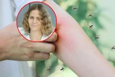 INWAZJA Plaga w Warszawie! Krwiożercze komary atakują, ale oprysków nie będzie