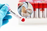 Alarm sanitarny w Olsztynie Odra w Olsztynie? Znamy wyniki badań pacjentki