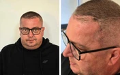 Liczy się każda złotówka Dariusz z Łosic walczy z wielkimi guzami. Rodzina: "Prosimy wszystkich o pomoc"