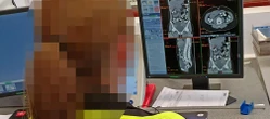 ŚMIERTELNE NIEBEZPIECZEŃSTWO Młoda kobieta przemycała to w żołądku. Wpadła na lotnisku Chopina
