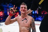 Poważna kontuzja Wstrząsająca wiadomość mistrza KSW! Zdradził to chwile po walce. "Da się wygrać ze z…