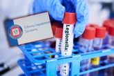 Bakterię wykryty w dwóch miejscach Legionella w jednym ze śląskich szpitali. Czy pacjenci są bezpieczni?