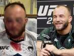 Ale miazga Zmasakrowana twarz polskiej gwiazdy UFC. Aż serce się kraje na ten widok. Mateusz Rę…