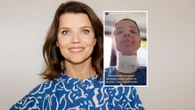 Gwiazdy Joanna Jabłczyńska z opatrunkiem na szyi. Aktorka zmaga się z problemami zdrowotnymi i apeluje o profilaktykę