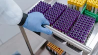 Coraz więcej ofiar epidemii. "Kontakty wysokiego ryzyka" w drodze do Europy