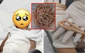 Un niño llega con dolor abdominal y le extirpan 142 lombrices del intestino en Chiapas