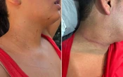 Video | Turistas denuncian agresión policial en Tepoztlán, Morelos