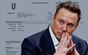 Elon Musk comparte un análisis de orina con resultados negativos de drogas