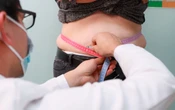 Sobrepeso y obesidad impactan el cerebro infantil: UNAM