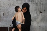 Aumenta desnutrición y mueren más de 18 mil niños en Gaza: UNICEF México