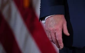 Casa Blanca confirma: Este es el problema de salud que padece Trump