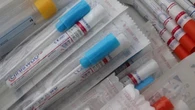 Swab Test Whole Genome Sequencing Mampu Deteksi Varian Baru COVID-19