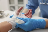 Opinion: Connecticut has one burn center. It deserves more support from state