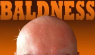 Joe Pisani (opinion): Let's not split hairs, I'm a role model for bald men