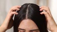 Vous avez des pellicules ? Voici comment savoir si elles sont grasses ou sèches (et quoi faire)