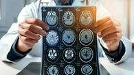 Alzheimer : comment la recherche médicale progresse pour diagnostiquer et traiter la maladie ?