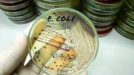 E.coli, listeria, salmonelles… Quelles sont ces bactéries qui peuvent dangereusement contaminer nos aliments ?