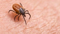 Morsures de tiques : qu'est-ce que le virus de Powassan qui inquiète aux États-Unis ?