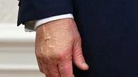"La transparence n'est pas du tout de mise dans l'administration Trump" : l'état de santé du président américain est-il vraiment "parfait" ?