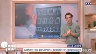 Allô le doc : Bientôt un dépistage du cancer du poumon