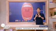Allô le doc : Angine, comment ne pas se tromper ?