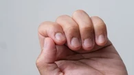 "On peut avoir des champignons, des virus" : se ronger les ongles est dangereux pour la santé