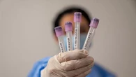 Hantavirus : les 22 Français cas contacts n'ont pas de symptômes, 4 mineurs testés négatifs