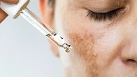 Vous utilisez des huiles essentielles ? Voici pourquoi elles ne font pas bon ménage avec le soleil