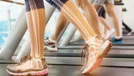 "Ils se renouvellent en permanence" : consommation de calcium, sport... Les conseils d'un médecin pour des os solides et en bonne santé