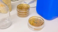 Diphtérie : la plus importante épidémie depuis 70 ans touche Europe de l'Ouest