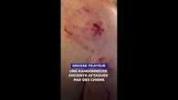 Grosse frayeur pour une randonneuse enceinte attaquée par deux chiens